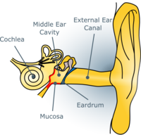 Caption Cartoon of the human ear. The red area shows the potentially inflamed mucosa.